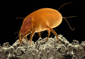 Magnification Of An Air Duct Dust Mite